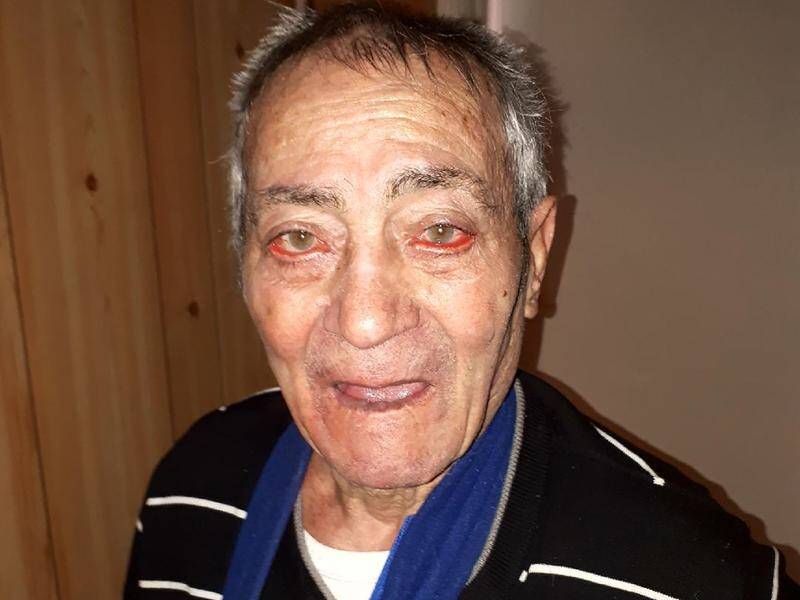 Police are concerned as missing Melbourne man Luigi Di Sante, 86, has short term memory loss.